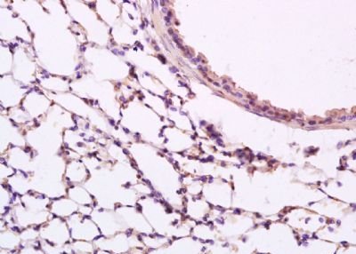 Src (phospho-Tyr418) antibody
